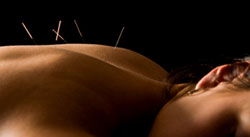acupuncture inside