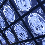 brain xray inside
