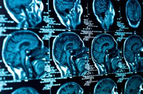 brain scan side