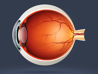 cataracts inside