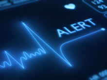 ekg monitor
