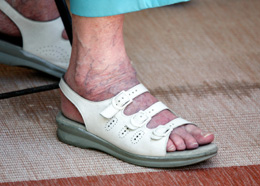 foot elderly woman