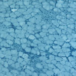muscle fibers
