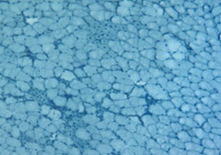muscle fibers