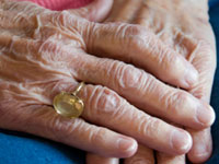 osteoarthritis hands inside