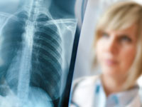 pneumonia