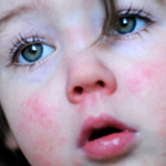 feverish baby