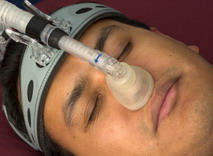 sleep apnea