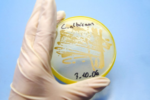 yeast petri dish