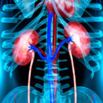Best Natural Diuretic Drinks Best Natural Diuretic Drinks