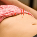 acupuncture weight loss