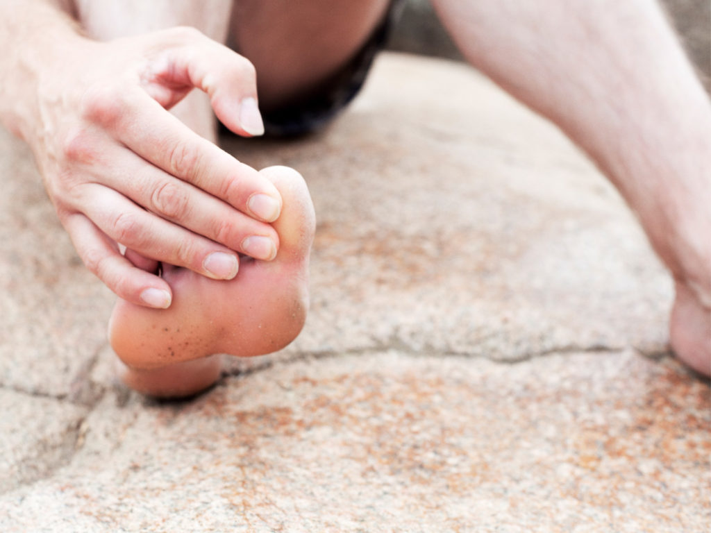 hampered by hammertoes