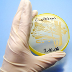 yeast_petri_dish_QA