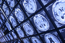 brain scan