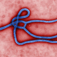 Ebola virus