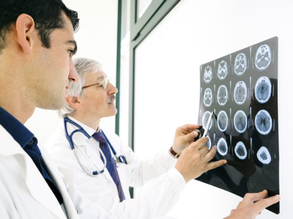 Doctors consult over an MRI scan of the brain.