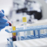 Laboratory assistant analyzing a blood sample