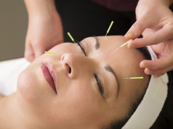 Spa series: middle aged woman in the spa getting acupuncture treatment. You might also be interested in these:
