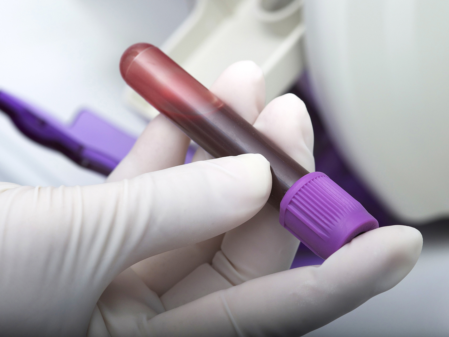 Is Hair Analysis Worthwhile? - Ask Dr. Weil Is Hair Analysis Worthwhile? - Ask Dr. Weil