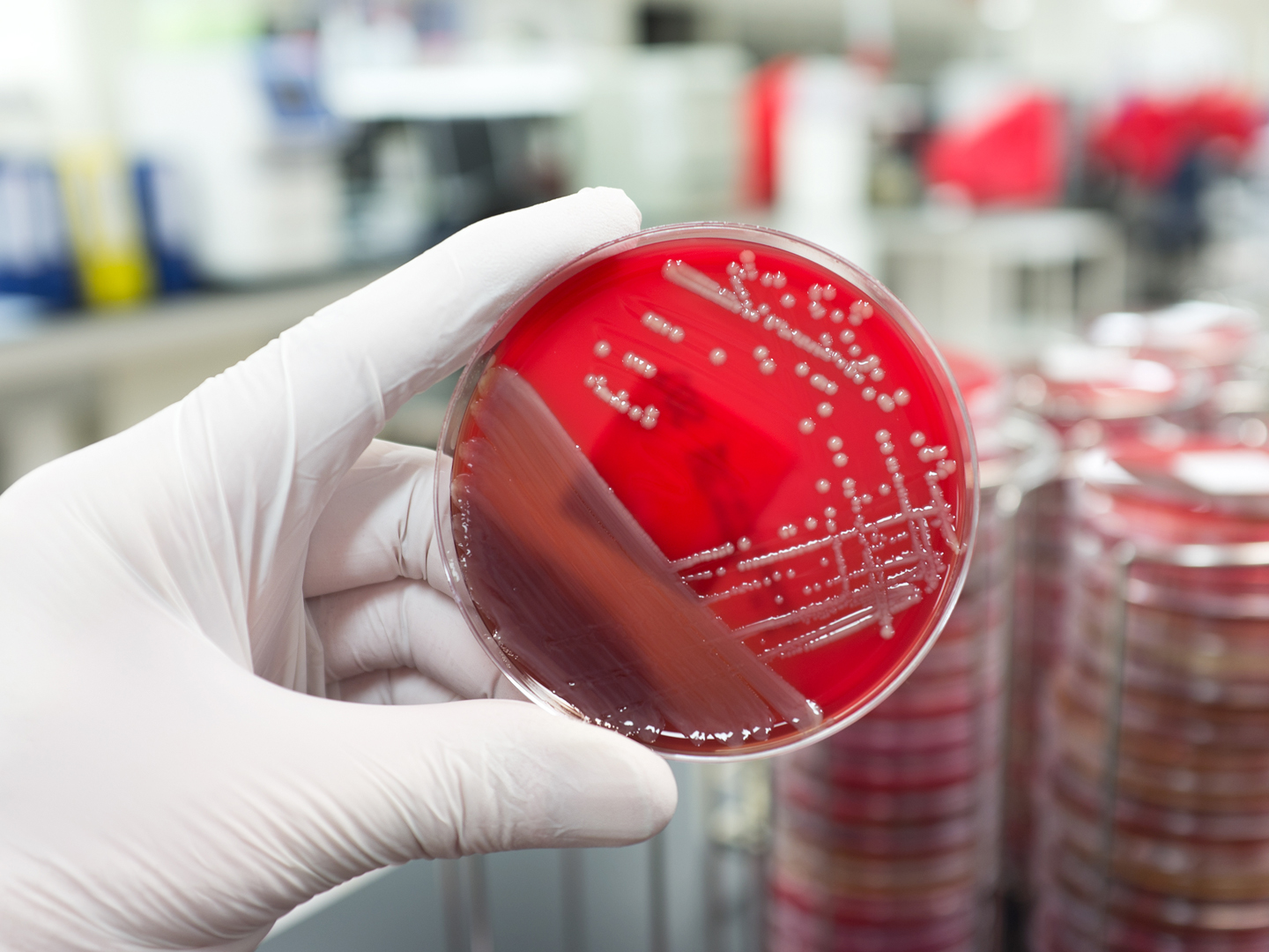 A hand with a medical glove is holding a agar plate with a culture of a pathogenic bacteria.