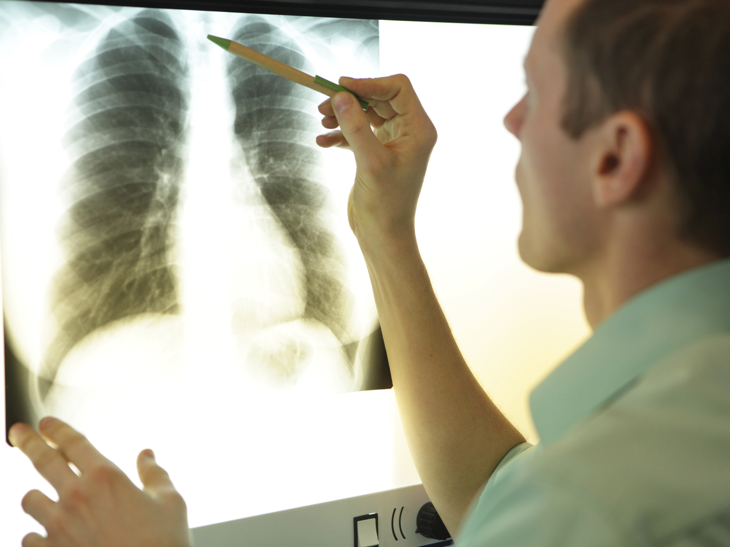specialist watching image of chest at x-ray film viewer