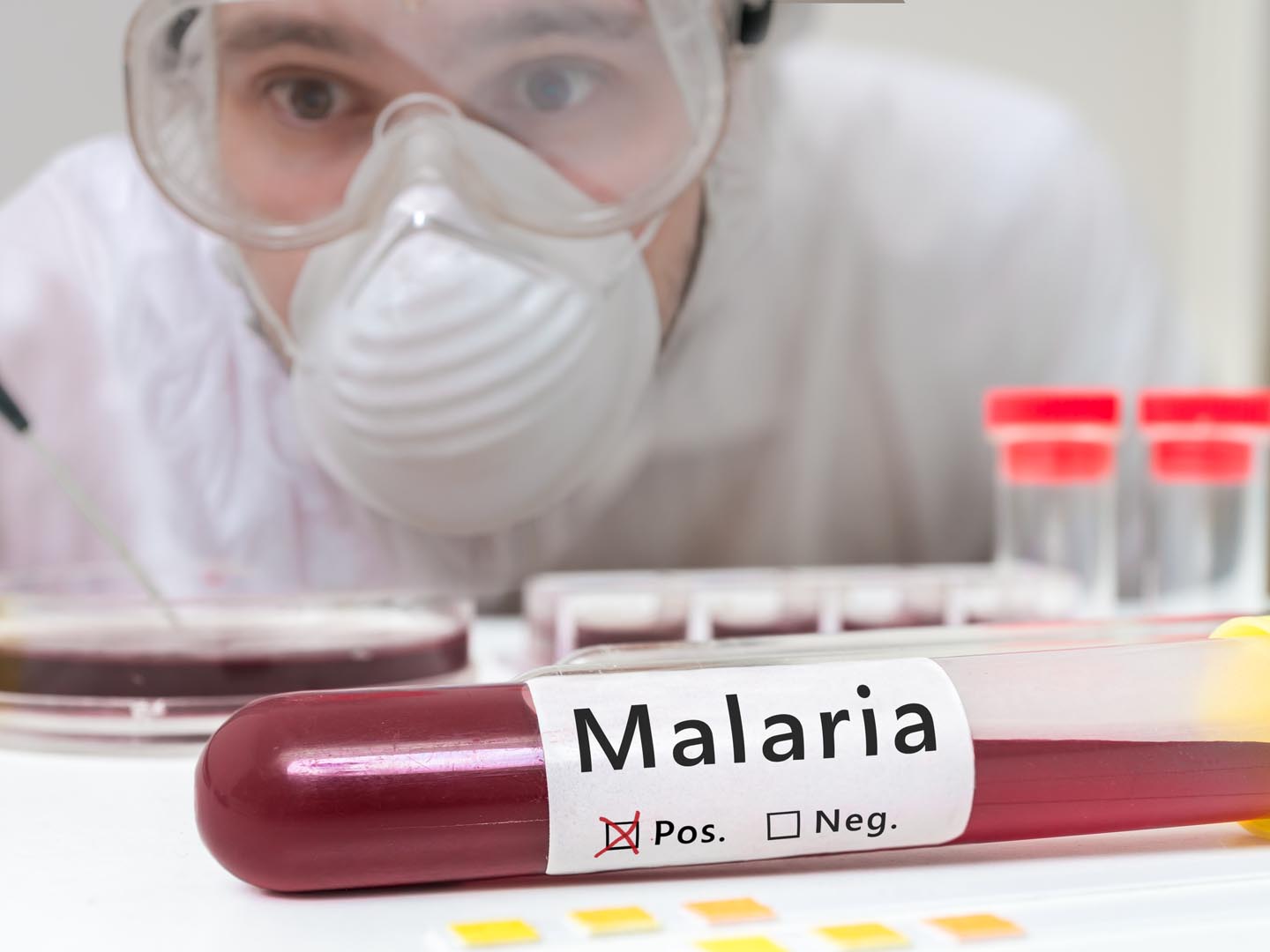 Researcher is analyzing test tube with Malaria.