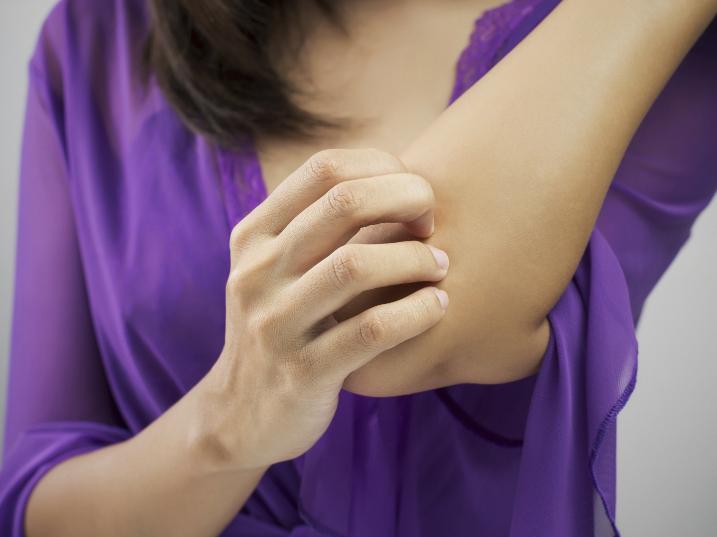 Woman scratching her arm