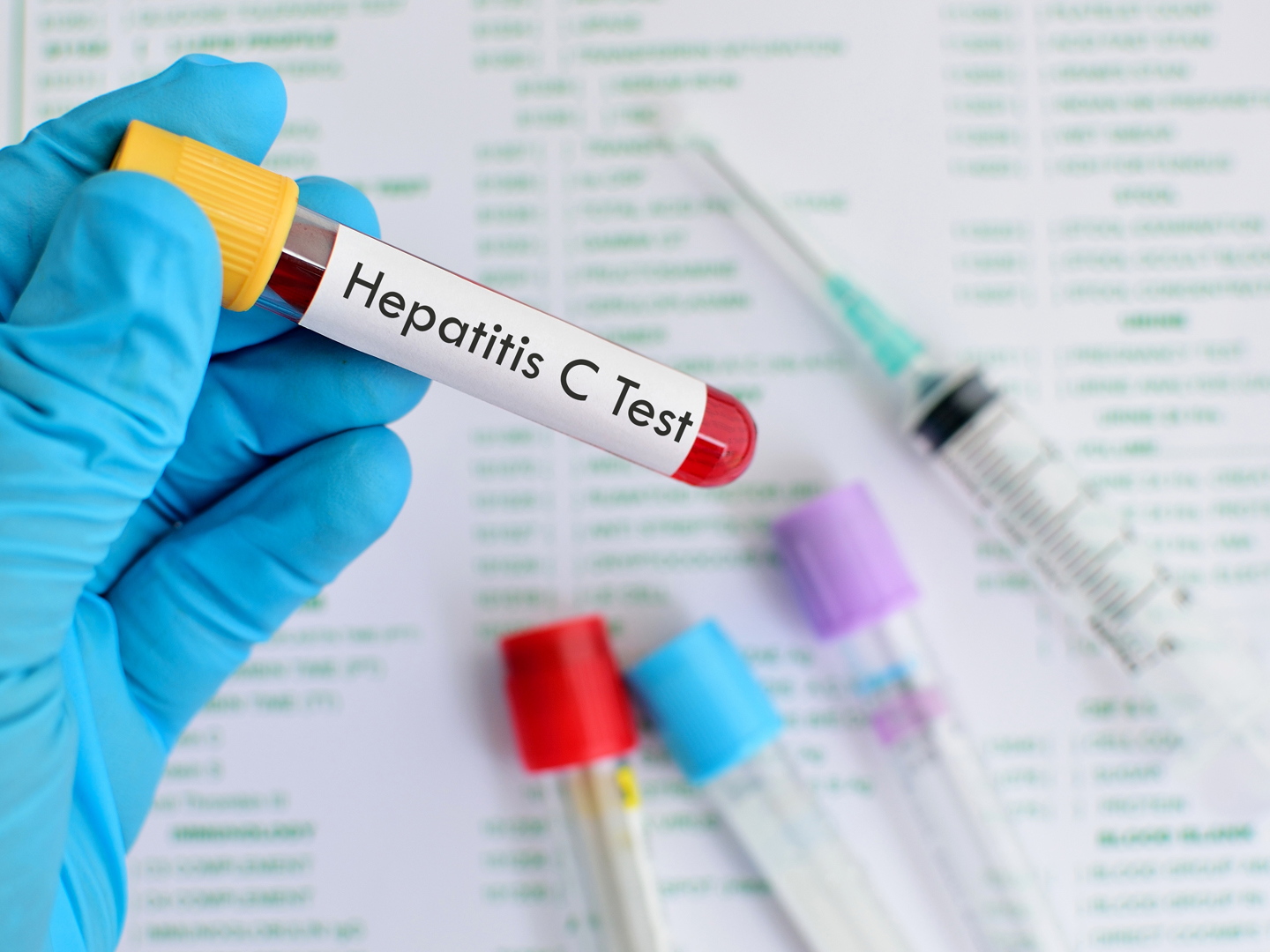 Should You Be Tested for Hepatitis C? | Liver &amp; Kidney | Andrew Weil, M.D.