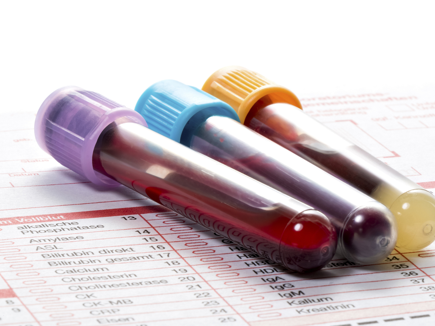 Blood samples are on a laboratory form for Finding out the blood values