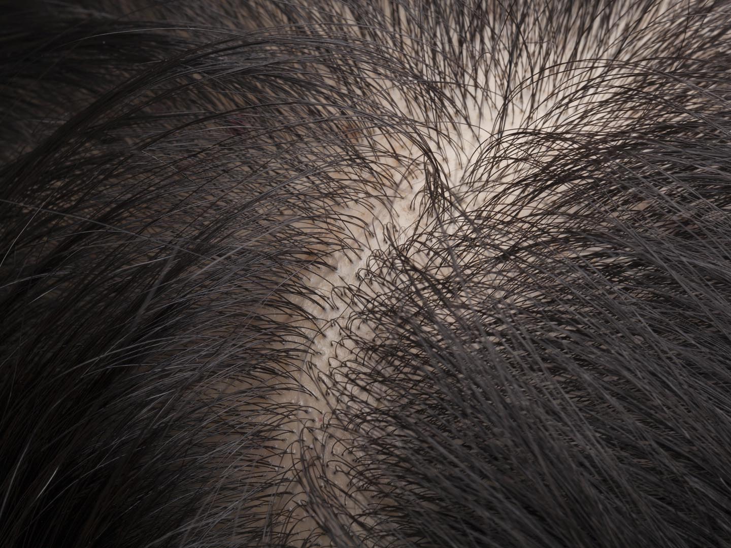 Closeup head with thinning hair and scalp