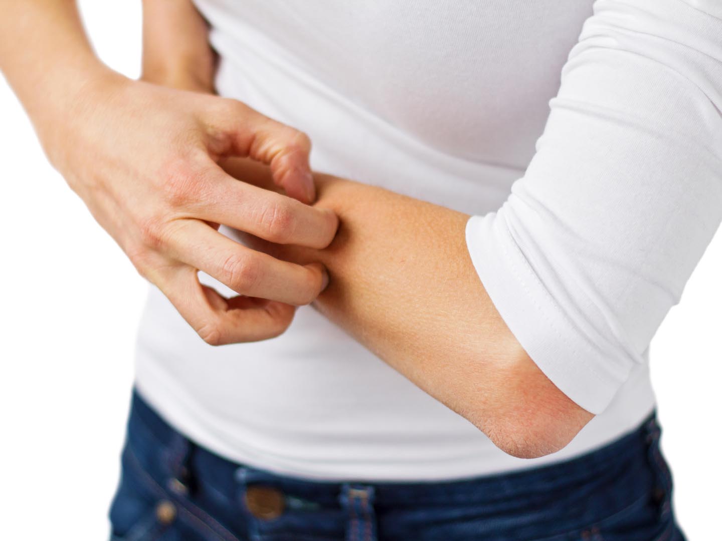 Woman suffering with dry and itchy skin, scratching her arm.