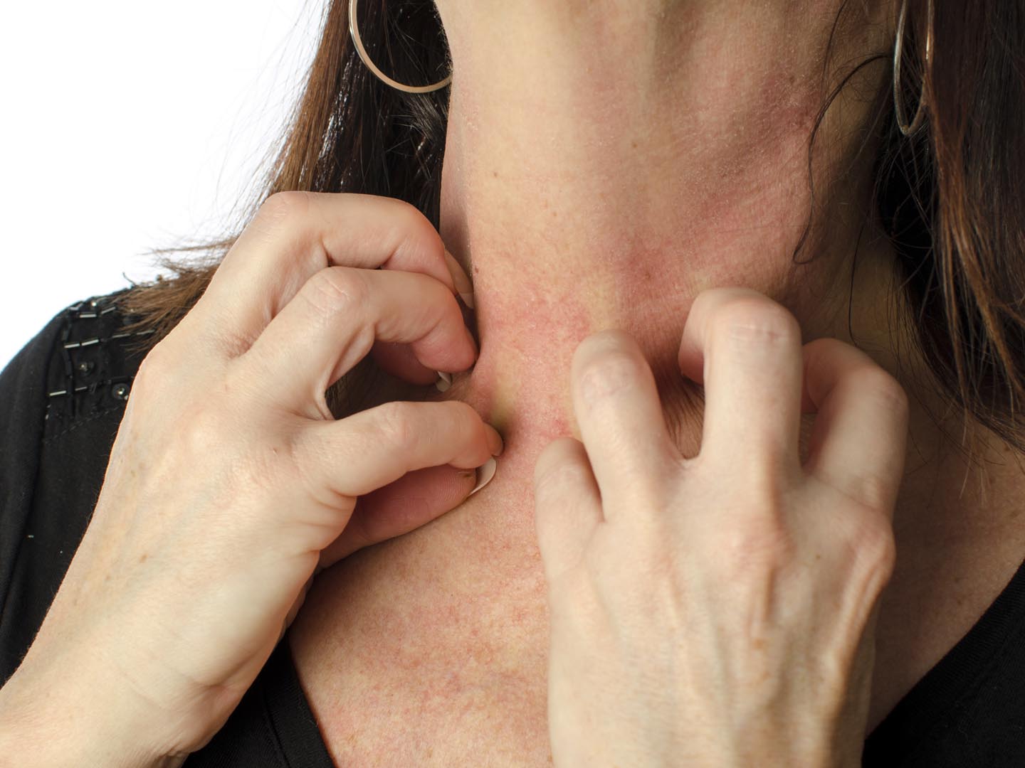 Woman scratching her neck, isolated on white