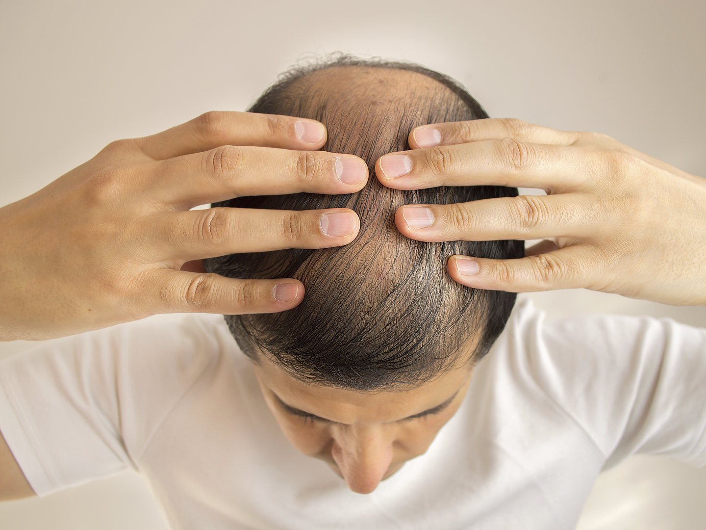 close up of man controls hair loss