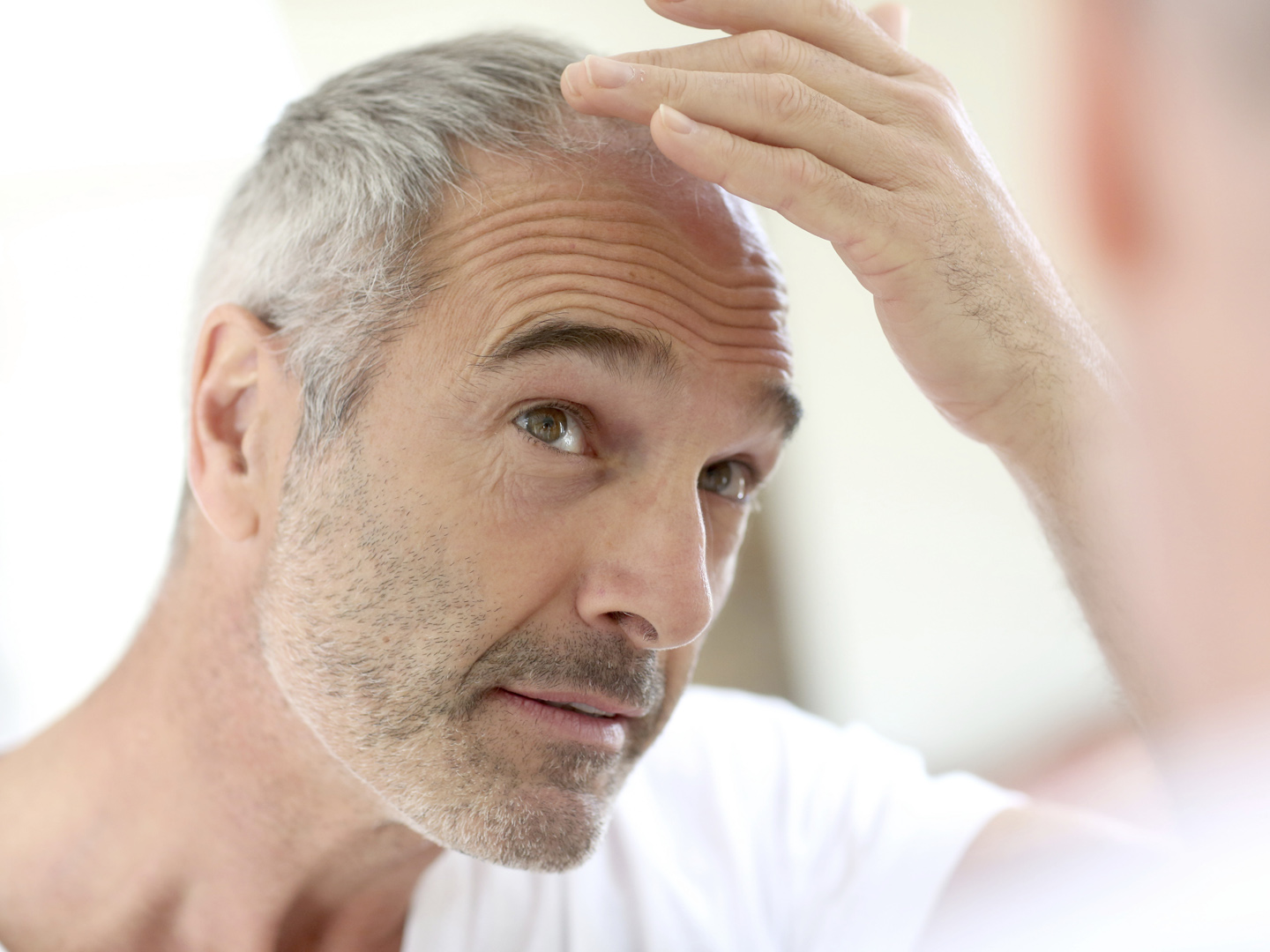 Senior man and hair loss issue