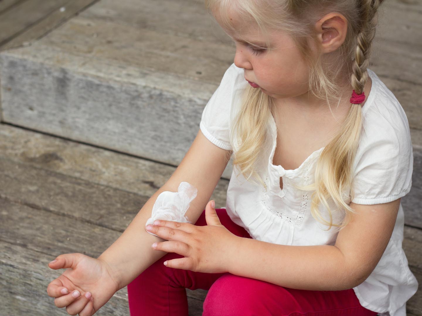 Girl applying dermatology cream on skin, eczema and skin allergy treatment.