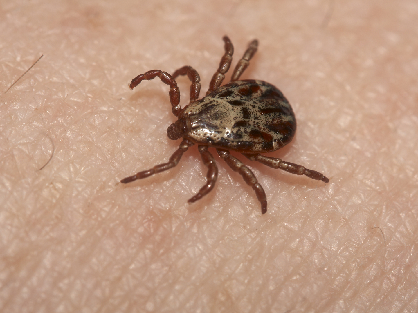 Another Tick Threat? | Insects &amp; Parasites | Andrew Weil, M.D.