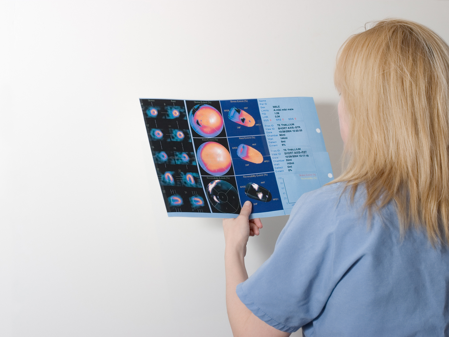 A nurse in a hospital room, looking at "Thallium Stress Test" results.