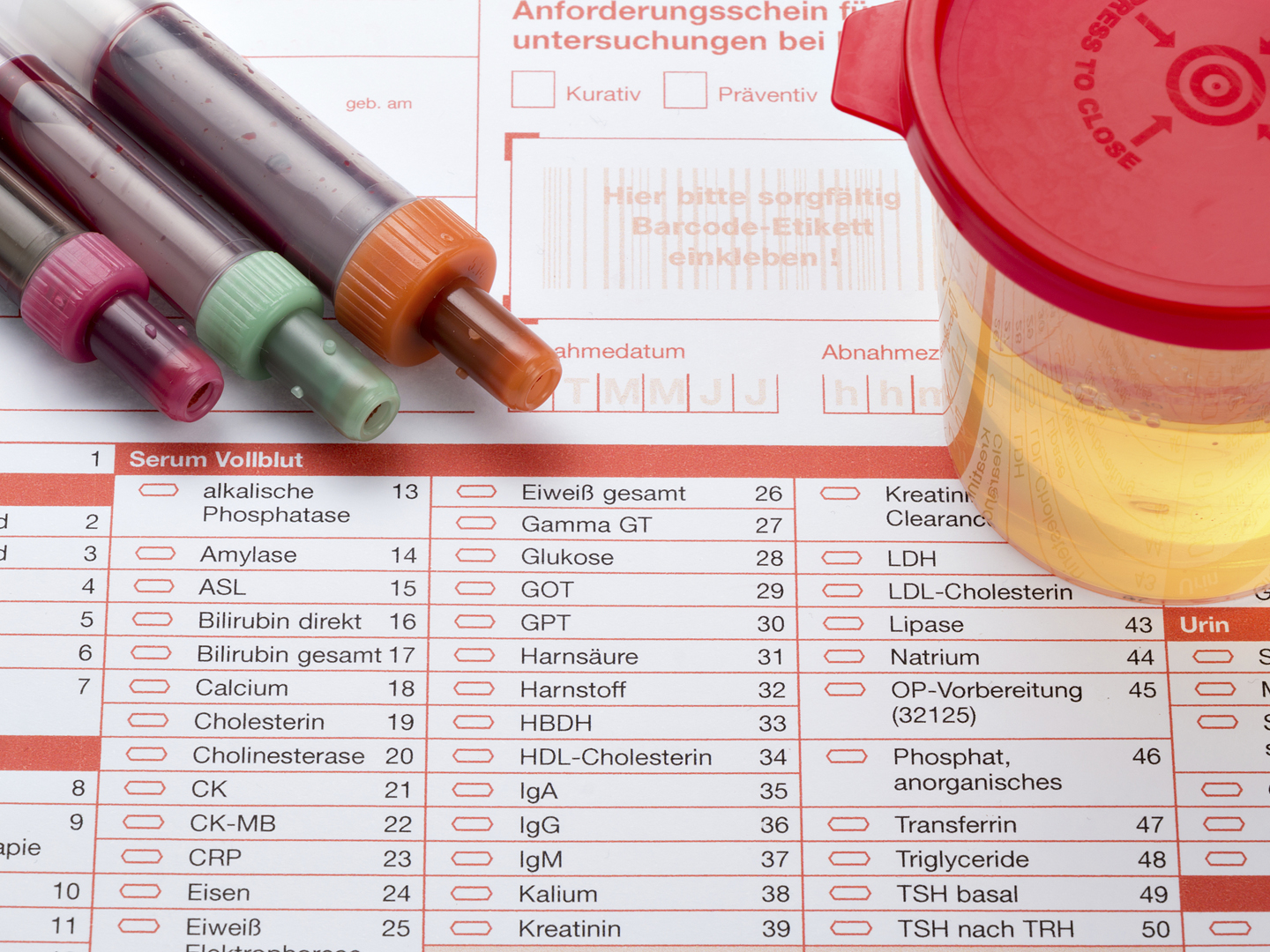 Urine and blood sample on a form for examination