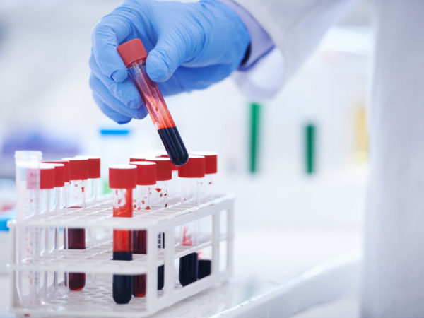 Cropped shot of a scientist holding a test tube filled with blood