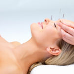 acupuncture for allergies