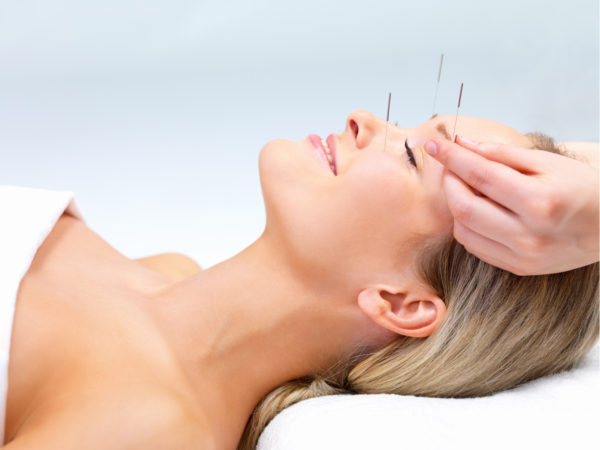 acupuncture for allergies