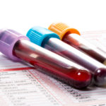 Blood samples are on a laboratory form for Finding out the blood values