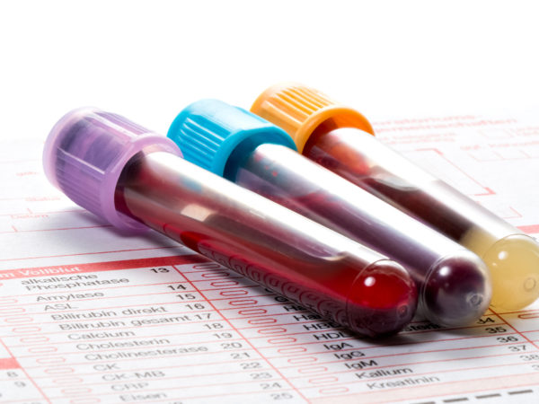 Blood samples are on a laboratory form for Finding out the blood values