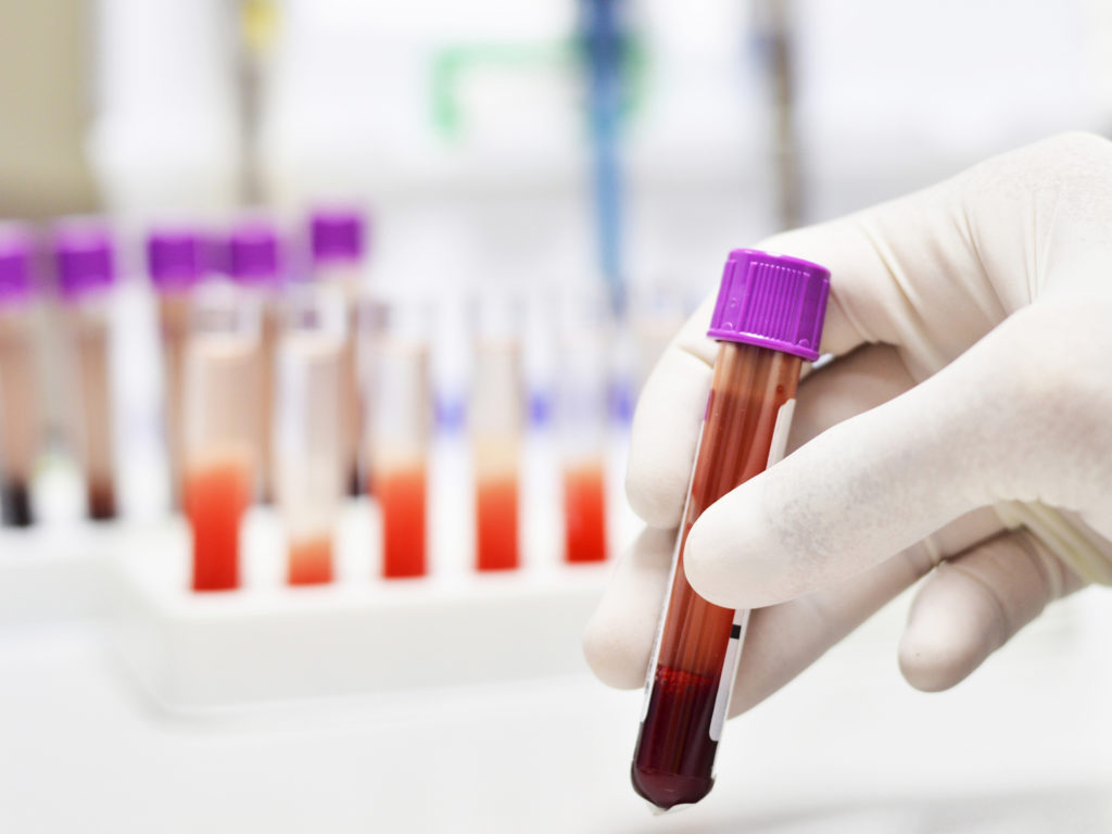a blood test for breast cancer