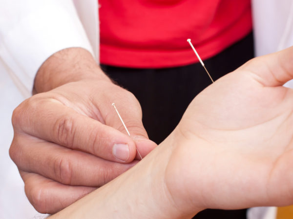 blog_bulletins_acupuncture-for-carpal-tunnel-syndrome_