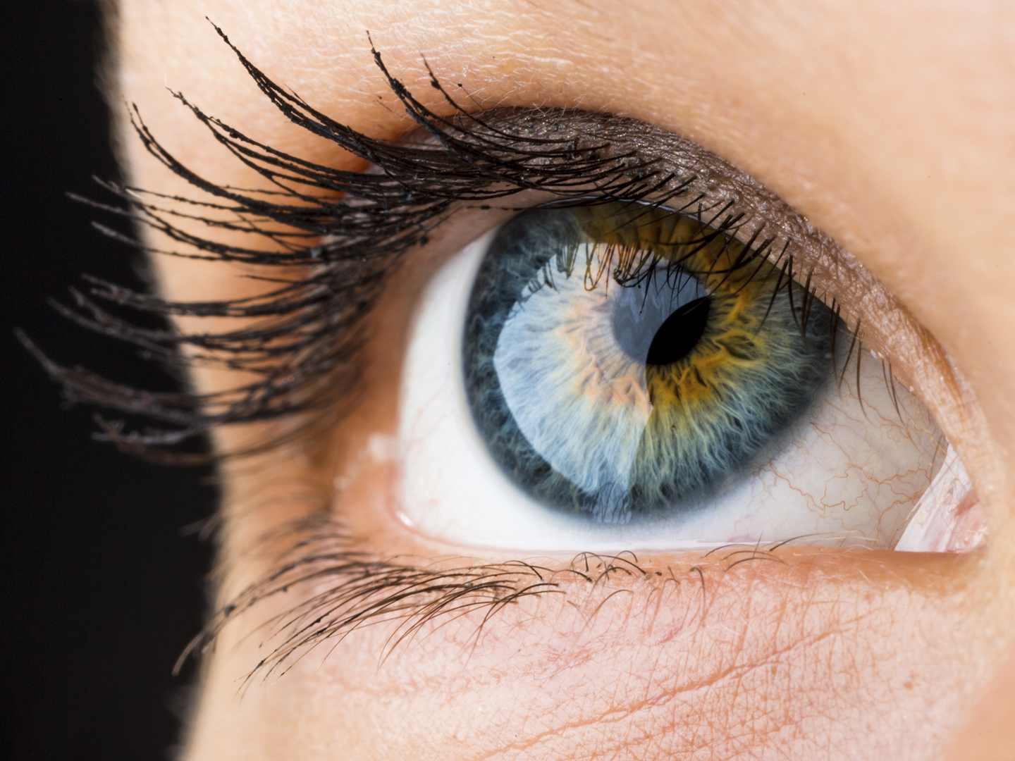Burst Blood Vessels In The Eye? | Vision | Andrew Weil, M.D.