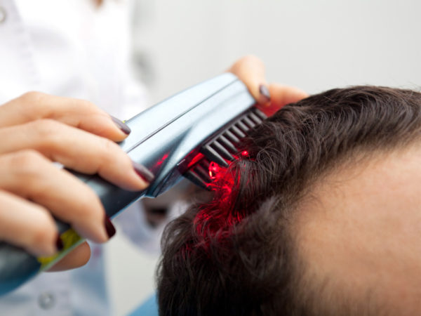 laser treatment for hair loss