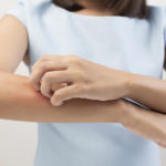 6 Ways To Address Itchy Skin This Summer
