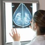 Do Mammograms Save Lives? | Andrew Weil, M.D.