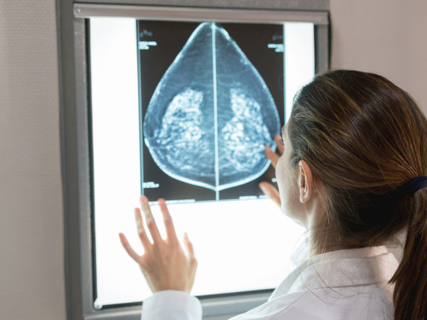 Do Mammograms Save Lives? | Andrew Weil, M.D.